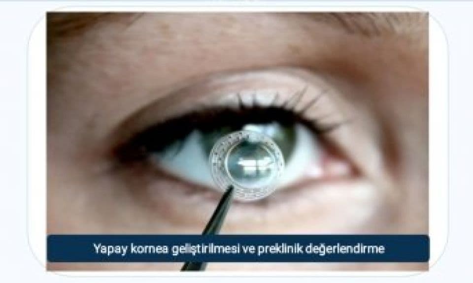 Çanakkale’de Göz Yaralanmalarına Yönelik Yapay Kornea Projesi 5 Milyon TL Destek Aldı